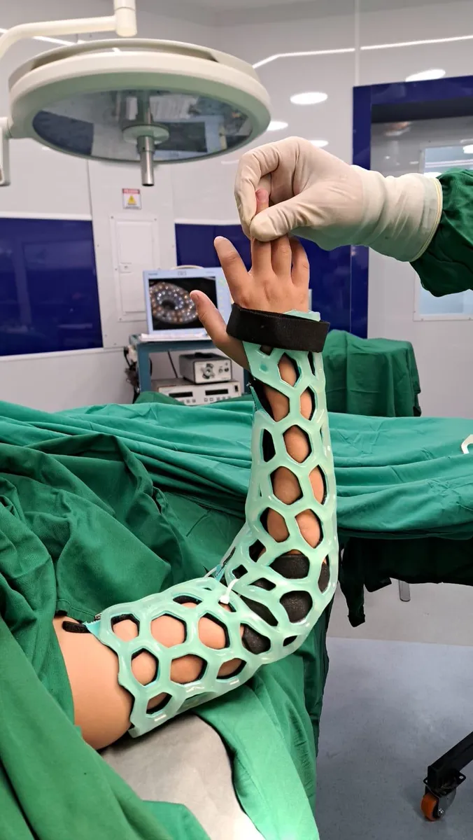 A cured FlexiOH short leg immobilizer on a patient's leg in an operating theatre