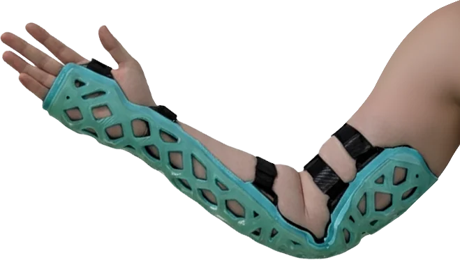 FlexiSplint