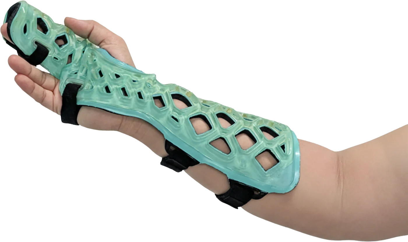 FlexiSplint Radial Gutter light-cured polymer splint