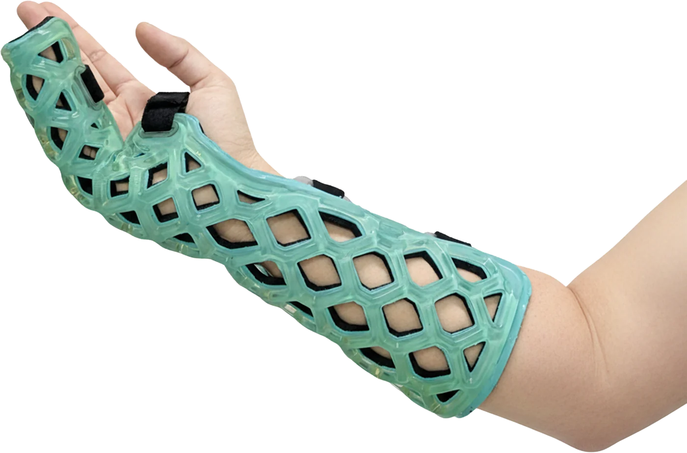 FlexiSplint Ulnar Gutter light-cured polymer splint