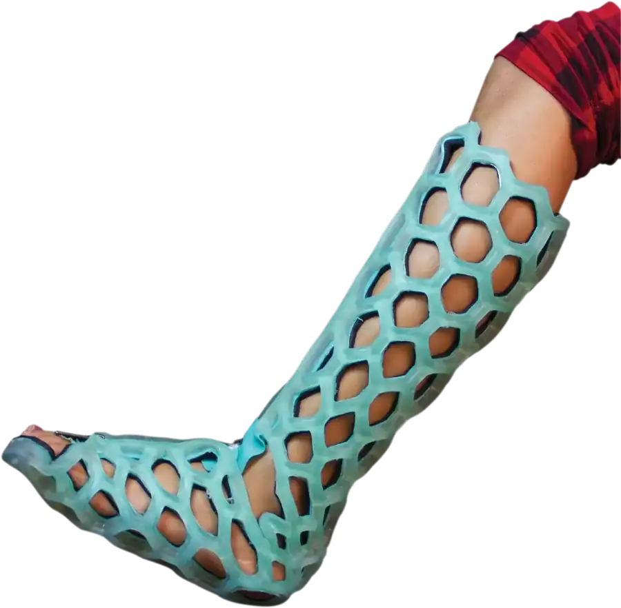 Short Leg Immobilizer — FlexiOH light-cured polymer immobilizer