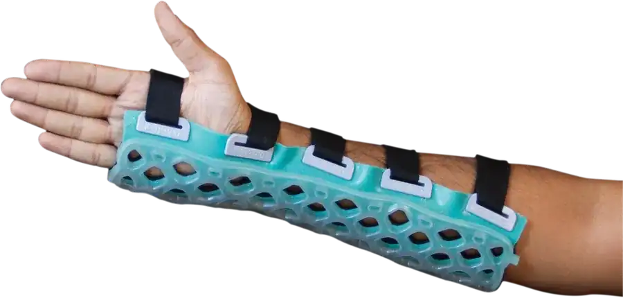 FlexiOH Splint / Slab — FlexiOH light-cured polymer immobilizer