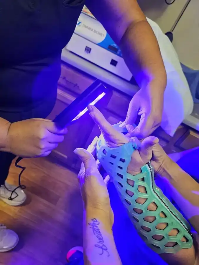 Close-up of RizyCure curing a FlexiOH immobilizer