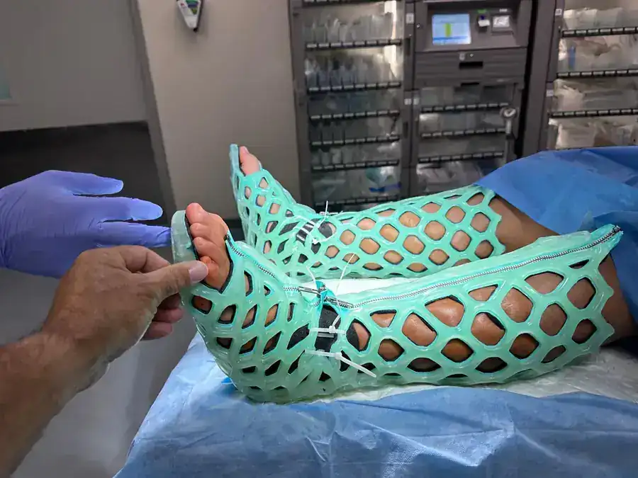 FlexiOH short leg immobilizer close-up