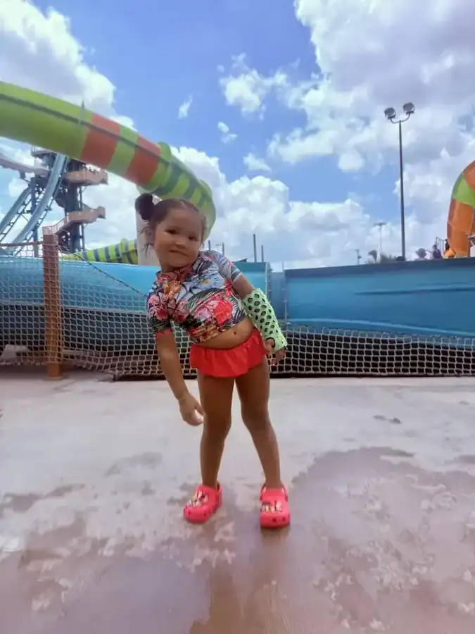 Child at a waterpark wearing a FlexiOH arm immobilizer
