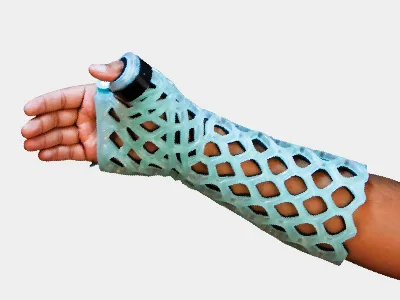Long Thumb Spica Immobilizer