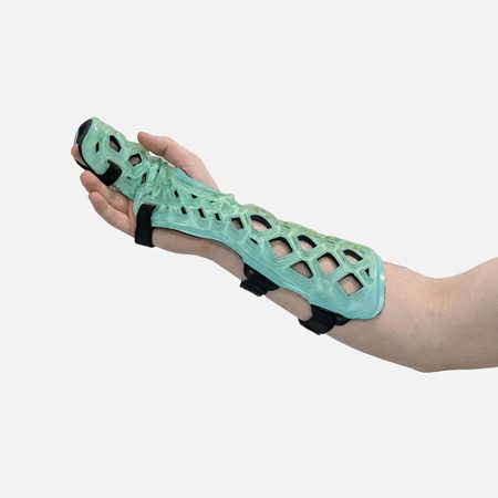 FlexiSplint